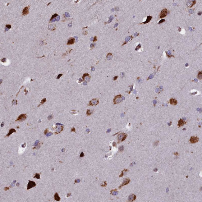 GLYATL3 Antibody in Immunohistochemistry (Paraffin) (IHC (P))