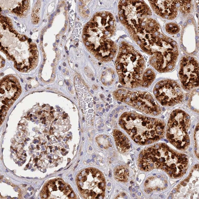 CPSF4L Antibody in Immunohistochemistry (Paraffin) (IHC (P))