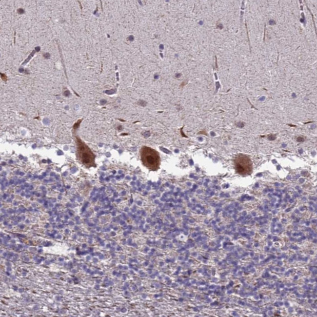 TROAP Antibody in Immunohistochemistry (Paraffin) (IHC (P))