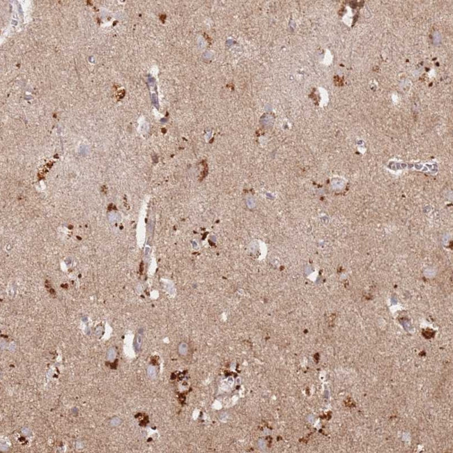 RIMBP2 Antibody in Immunohistochemistry (Paraffin) (IHC (P))
