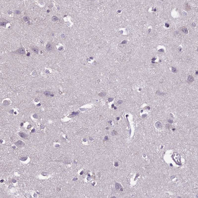 FBRS Antibody in Immunohistochemistry (Paraffin) (IHC (P))