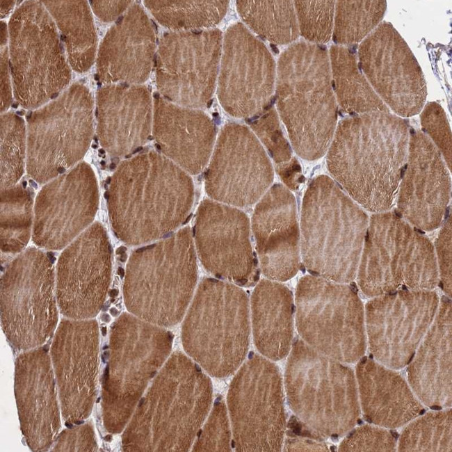 FAM184B Antibody in Immunohistochemistry (Paraffin) (IHC (P))