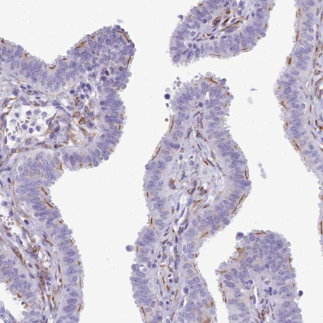 CC2D2A Antibody in Immunohistochemistry (Paraffin) (IHC (P))
