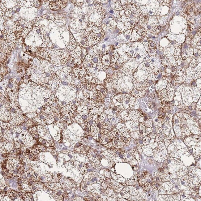 MOB4 Antibody in Immunohistochemistry (IHC)