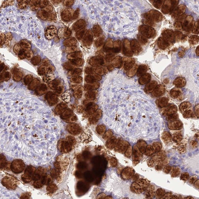 DHDH Antibody in Immunohistochemistry (Paraffin) (IHC (P))