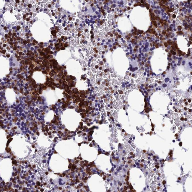MFSD2B Antibody in Immunohistochemistry (Paraffin) (IHC (P))