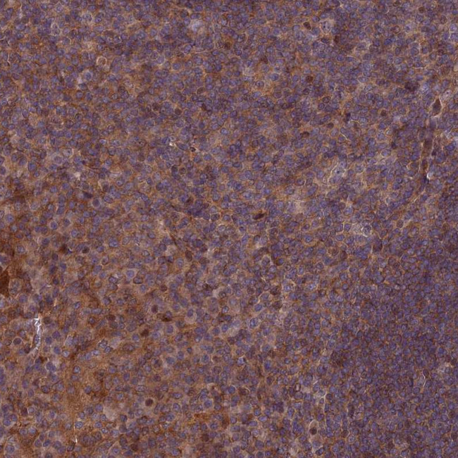 COMMD2 Antibody in Immunohistochemistry (Paraffin) (IHC (P))