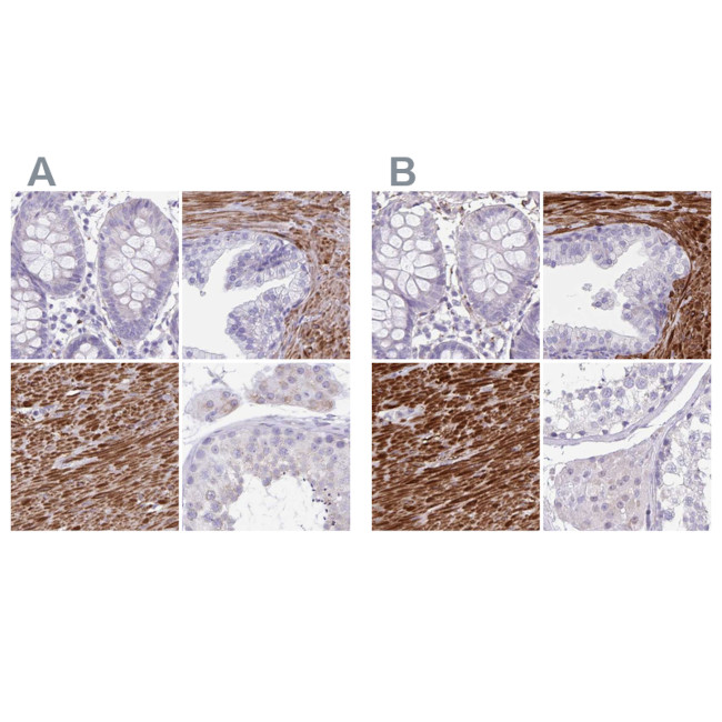 SYNM Antibody in Immunohistochemistry (IHC)