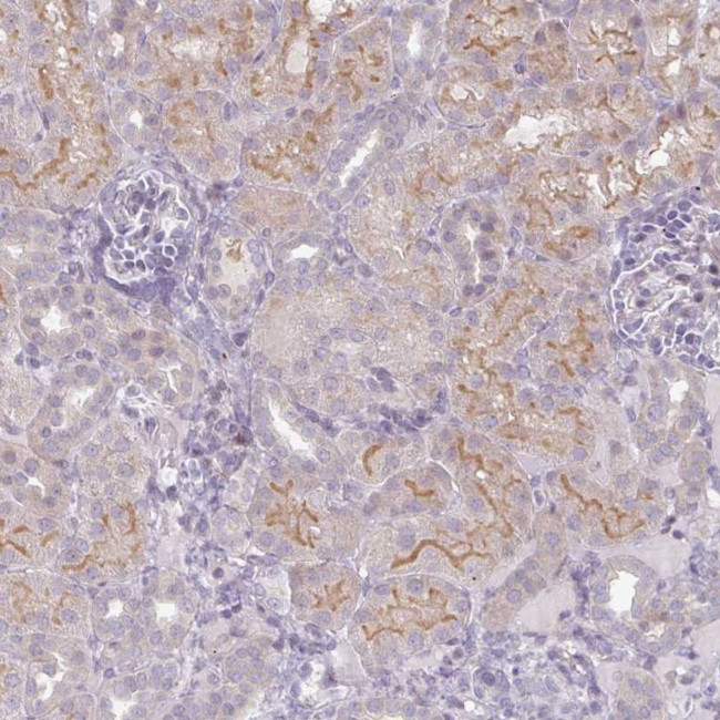 GASP2 Antibody in Immunohistochemistry (Paraffin) (IHC (P))