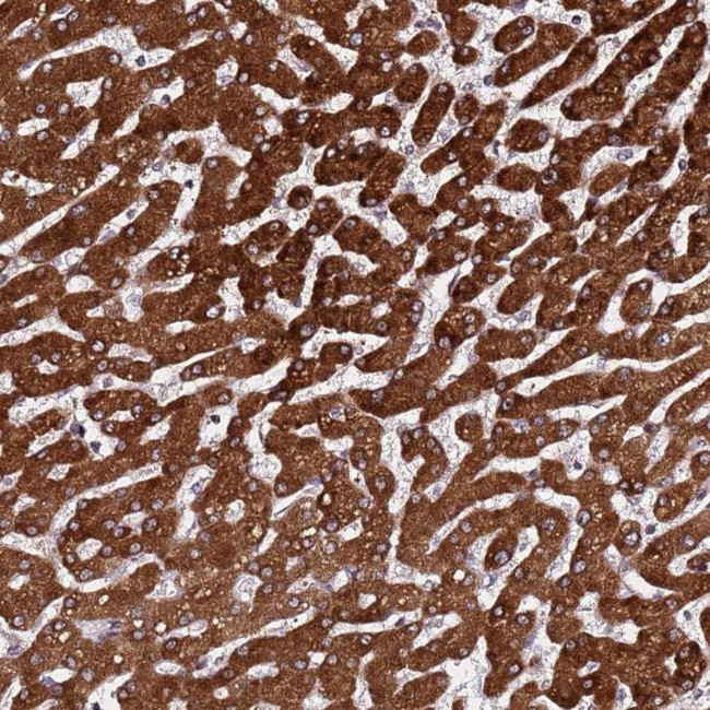 PPM1H Antibody in Immunohistochemistry (Paraffin) (IHC (P))