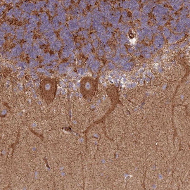 SNRNP25 Antibody in Immunohistochemistry (IHC)