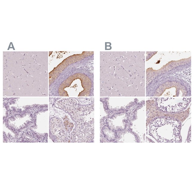 ELSPBP1 Antibody in Immunohistochemistry (Paraffin) (IHC (P))