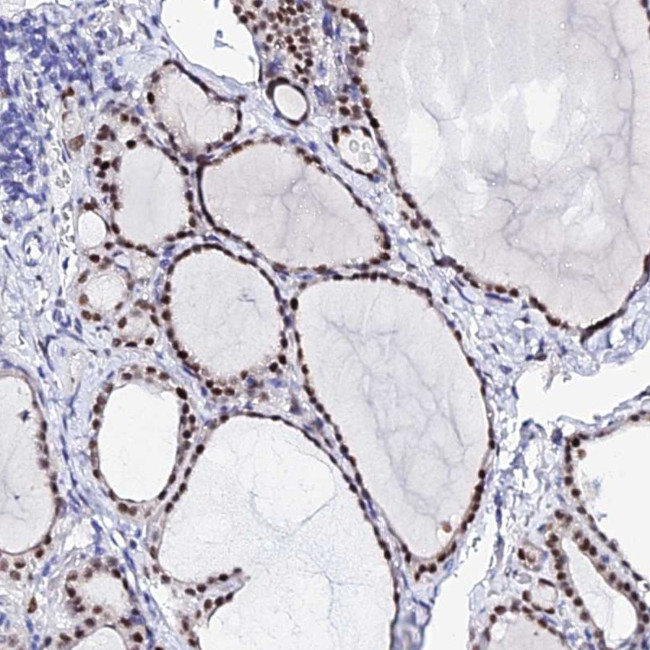 POFUT2 Antibody in Immunohistochemistry (Paraffin) (IHC (P))