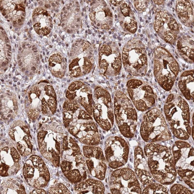 p53AIP1 Antibody in Immunohistochemistry (Paraffin) (IHC (P))