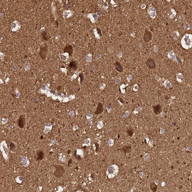 ADAMTS18 Antibody in Immunohistochemistry (Paraffin) (IHC (P))