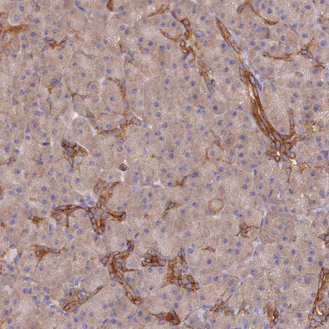ARRDC1 Antibody in Immunohistochemistry (Paraffin) (IHC (P))