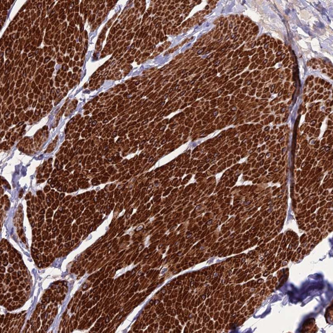 CLUH Antibody in Immunohistochemistry (Paraffin) (IHC (P))