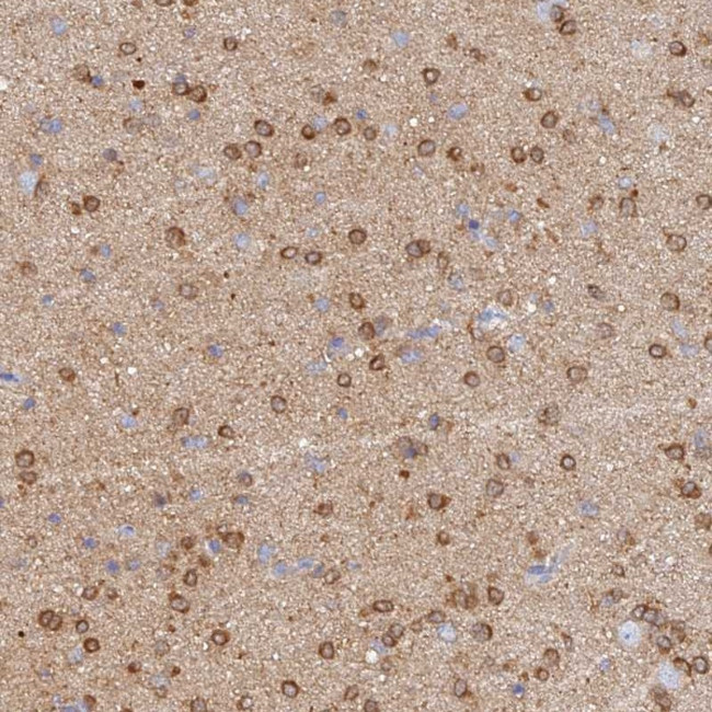 CACNA1B Antibody in Immunohistochemistry (Paraffin) (IHC (P))