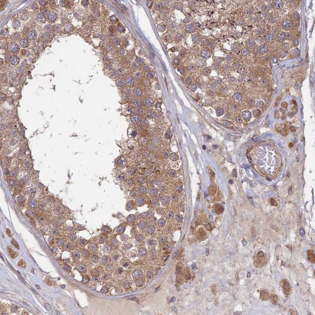 INCA1 Antibody in Immunohistochemistry (Paraffin) (IHC (P))