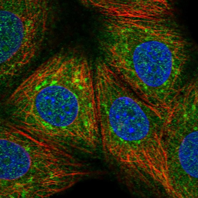 USP32 Antibody in Immunocytochemistry (ICC/IF)