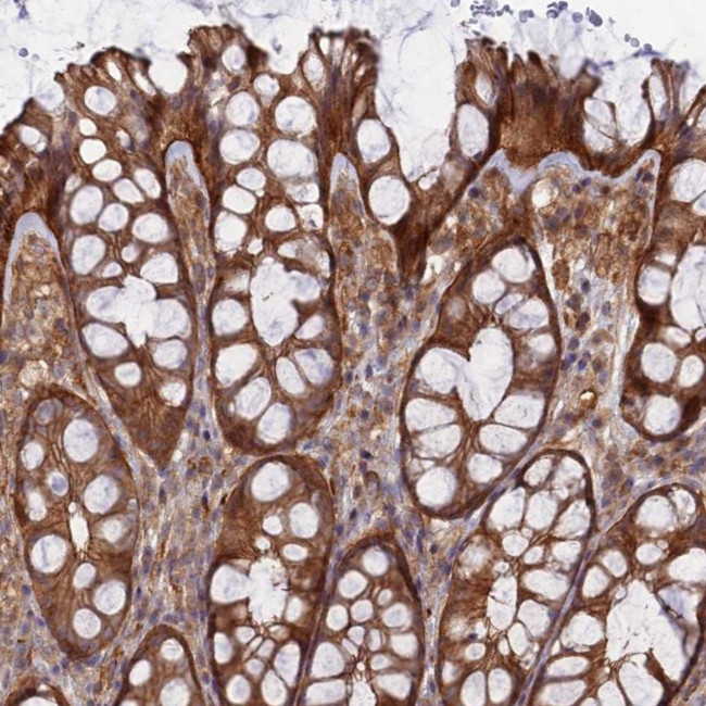 ABHD1 Antibody in Immunohistochemistry (Paraffin) (IHC (P))
