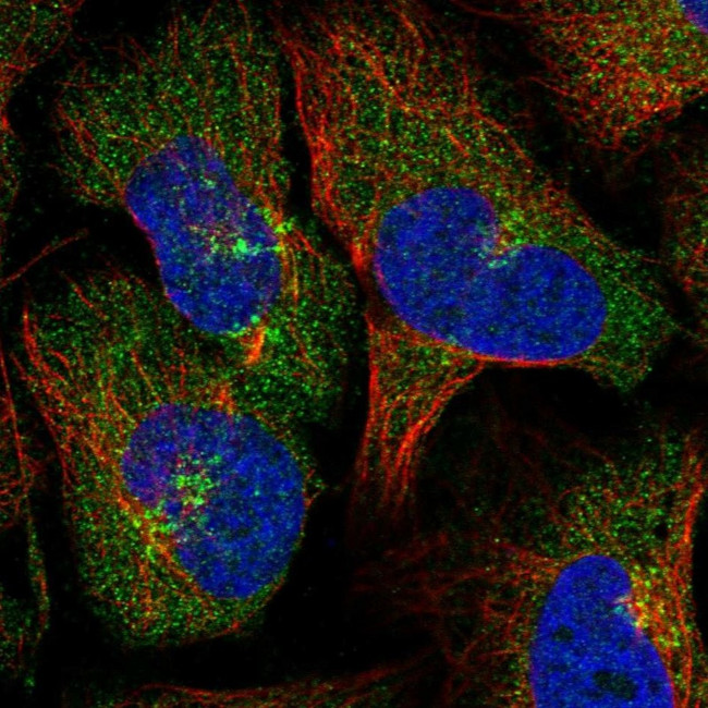 LACTB2 Antibody in Immunocytochemistry (ICC/IF)