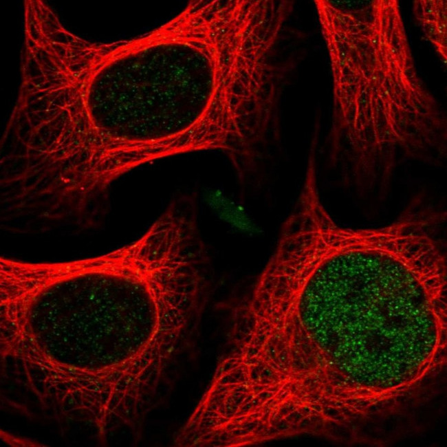 CASD1 Antibody in Immunocytochemistry (ICC/IF)