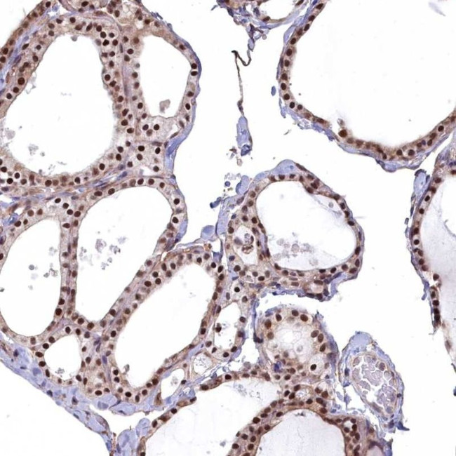 MAK16 Antibody in Immunohistochemistry (IHC)