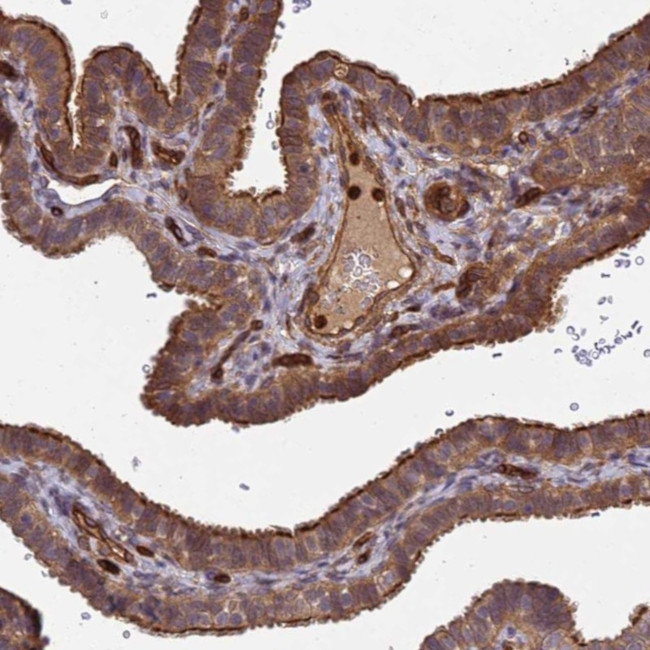 C8orf34 Antibody in Immunohistochemistry (Paraffin) (IHC (P))