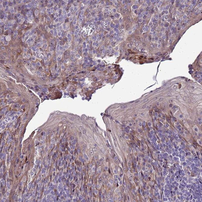 NOL8 Antibody in Immunohistochemistry (IHC)