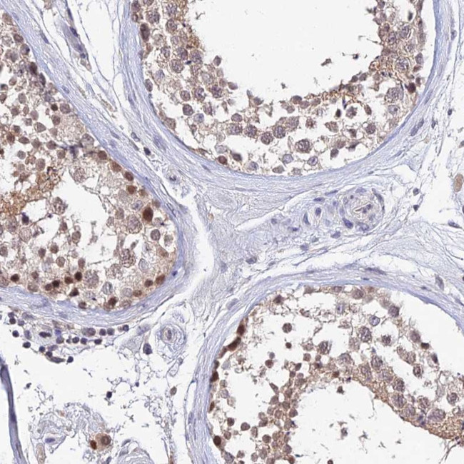 TEKT1 Antibody in Immunohistochemistry (Paraffin) (IHC (P))