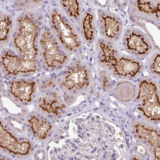 TMEM62 Antibody in Immunohistochemistry (Paraffin) (IHC (P))
