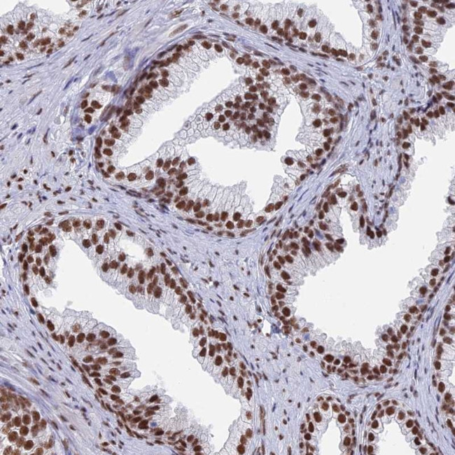 ZNF280A Antibody in Immunohistochemistry (Paraffin) (IHC (P))