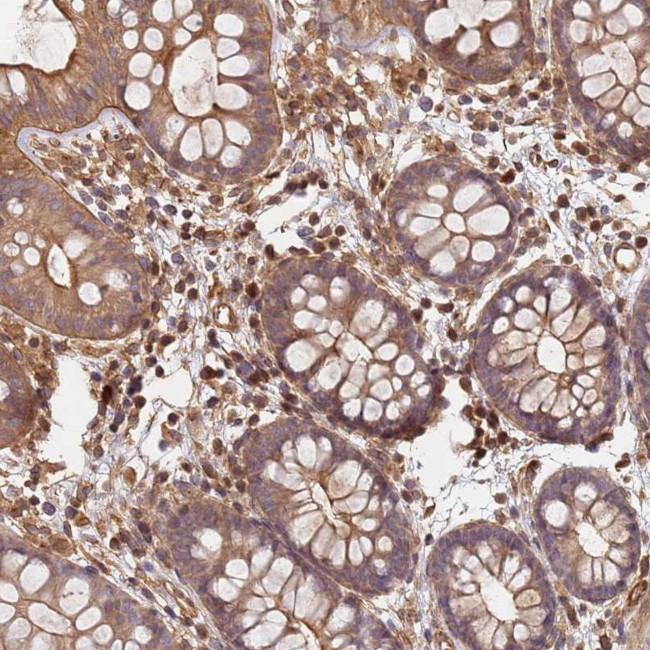 SDCCAG8 Antibody in Immunohistochemistry (Paraffin) (IHC (P))