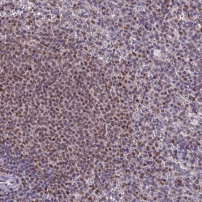 MIS12 Antibody in Immunohistochemistry (IHC)