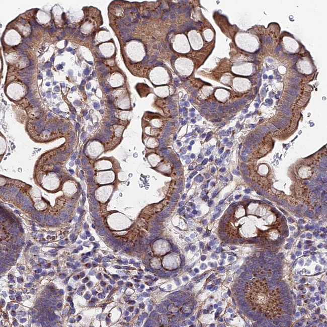 GPR113 Antibody in Immunohistochemistry (Paraffin) (IHC (P))