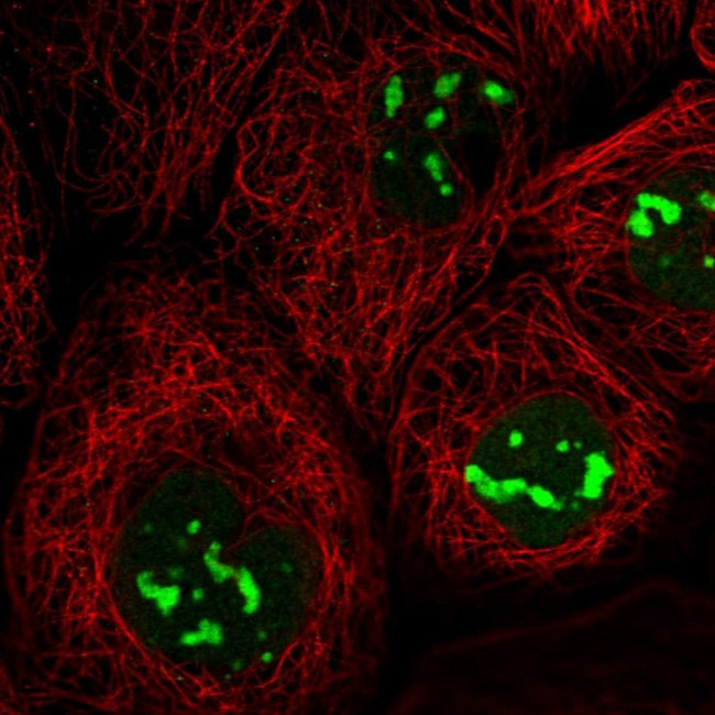 TDIF2 Antibody in Immunocytochemistry (ICC/IF)