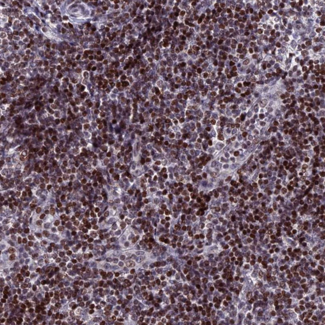 LAF4 Antibody in Immunohistochemistry (Paraffin) (IHC (P))