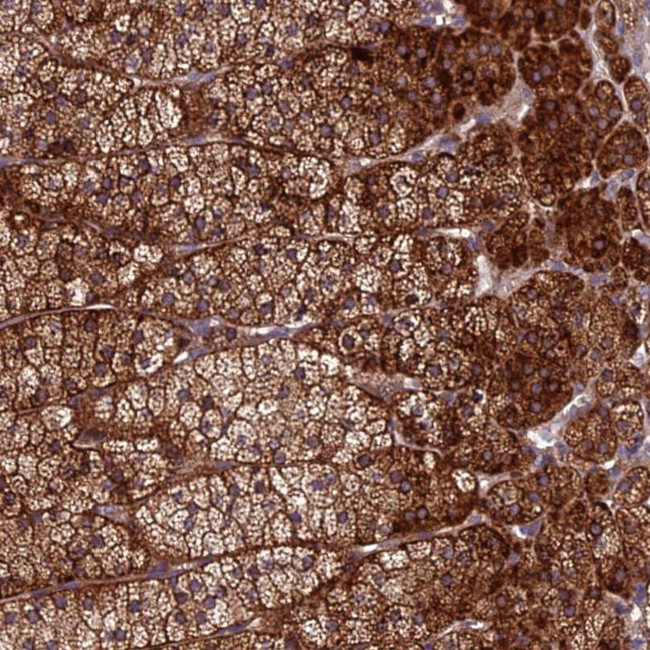 CENPL Antibody in Immunohistochemistry (Paraffin) (IHC (P))