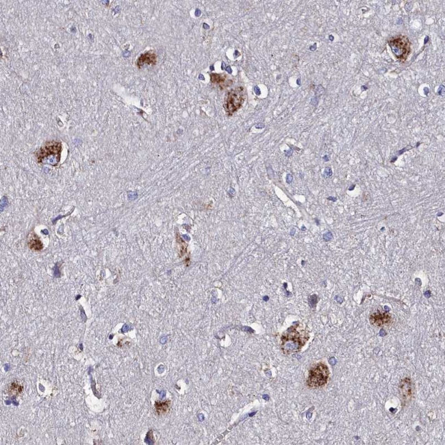 KIAA1324L Antibody in Immunohistochemistry (Paraffin) (IHC (P))