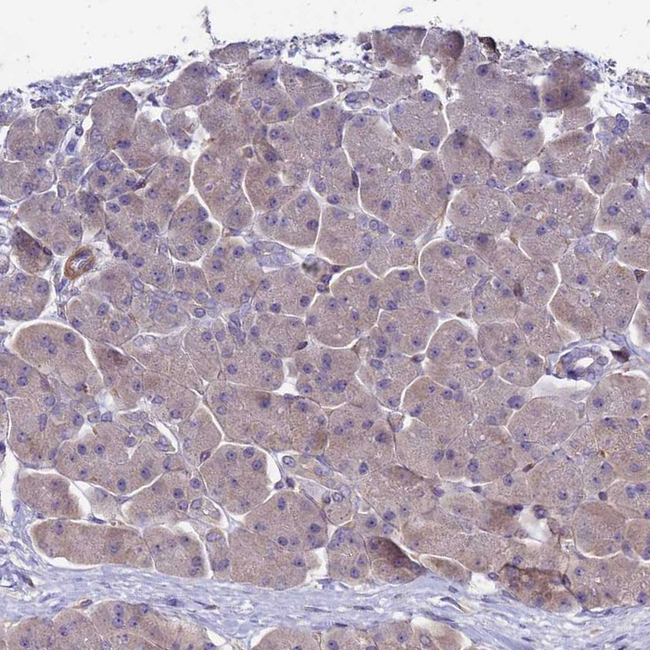 ETNPPL Isoform 1 Antibody in Immunohistochemistry (Paraffin) (IHC (P))