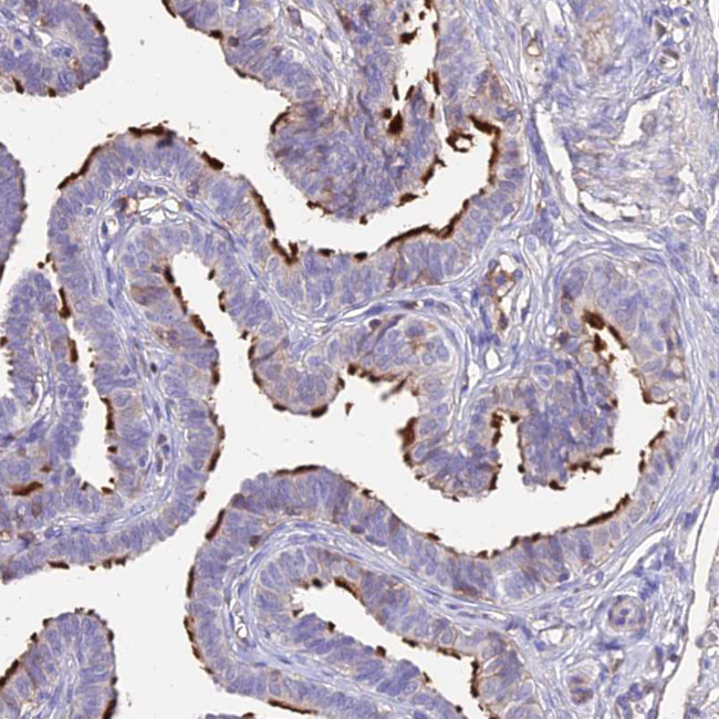 NME5 Antibody in Immunohistochemistry (Paraffin) (IHC (P))