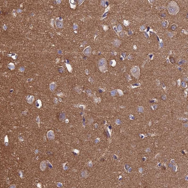 PCDHA5 Antibody in Immunohistochemistry (Paraffin) (IHC (P))