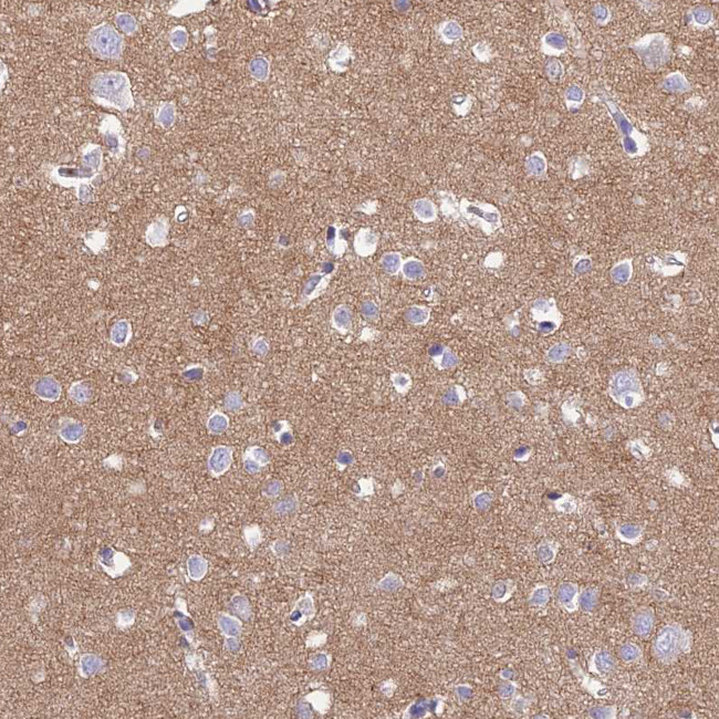 TMEM161B Antibody in Immunohistochemistry (Paraffin) (IHC (P))