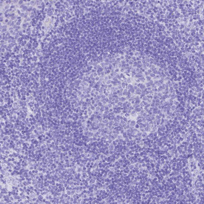 SMR3A Antibody in Immunohistochemistry (Paraffin) (IHC (P))