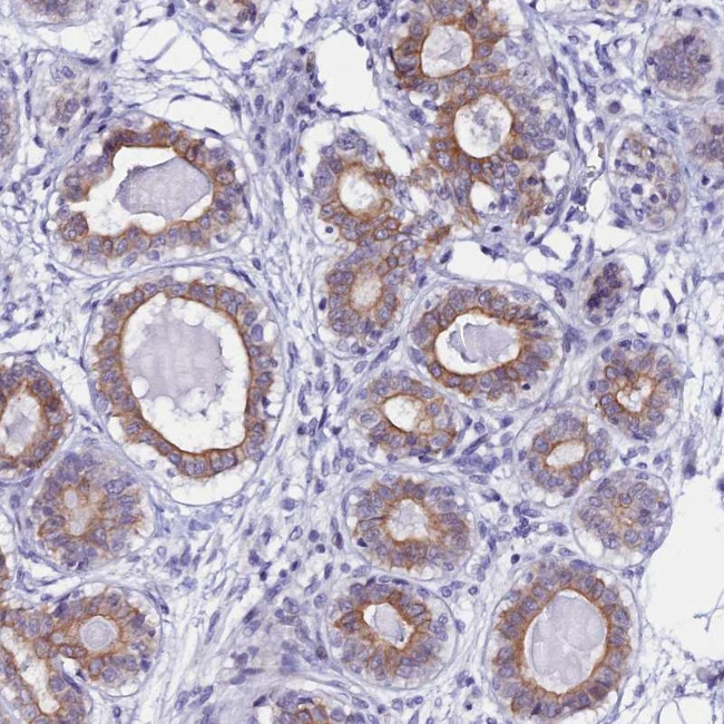 RASGEF1B Antibody in Immunohistochemistry (Paraffin) (IHC (P))