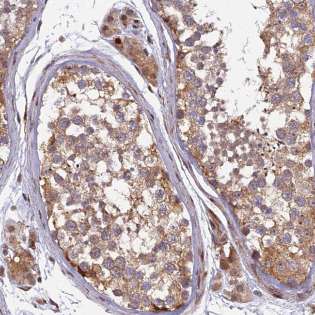 RAB28 Antibody in Immunohistochemistry (IHC)