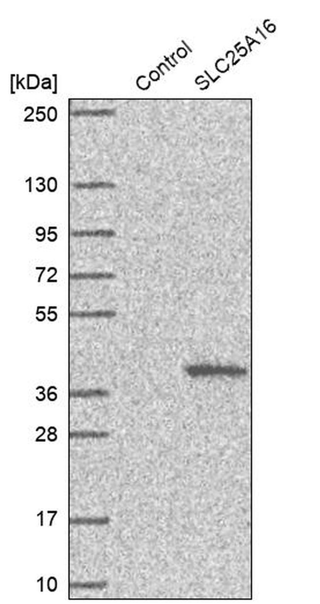 SLC25A16 Antibody in Western Blot (WB)
