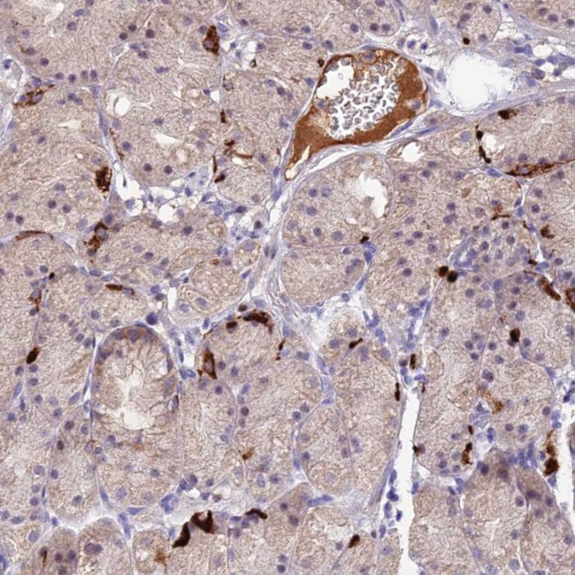 ACSM6 Antibody in Immunohistochemistry (Paraffin) (IHC (P))