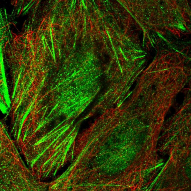 TIGD6 Antibody in Immunocytochemistry (ICC/IF)